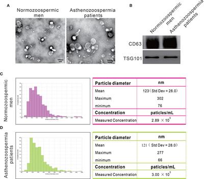 Decreased piRNAs in Infertile Semen Are Related to Downregulation of Sperm MitoPLD Expression